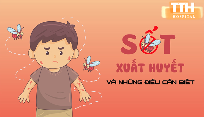 Sốt Xuất Huyết và Những Biến Chứng Đe Dọa Tính Mạng: Hướng Dẫn Toàn Diện